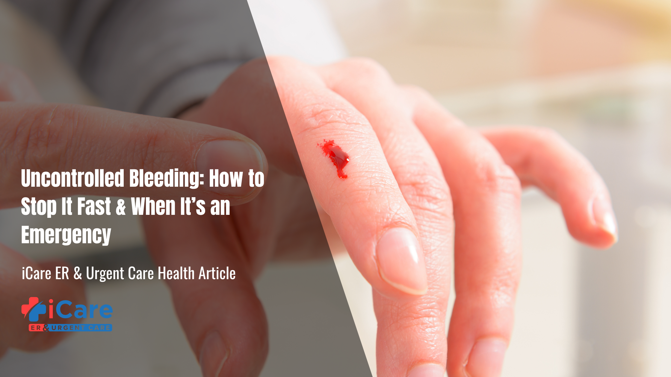 Uncontrolled Bleeding: How to Stop It Fast & When It’s an Emergency